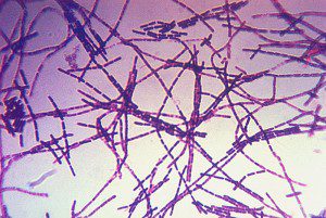 Bacillus_anthracis_Gram