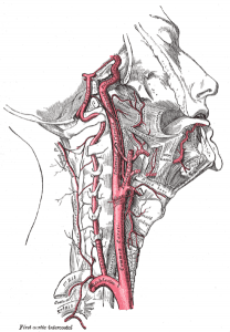 Strangu;ation