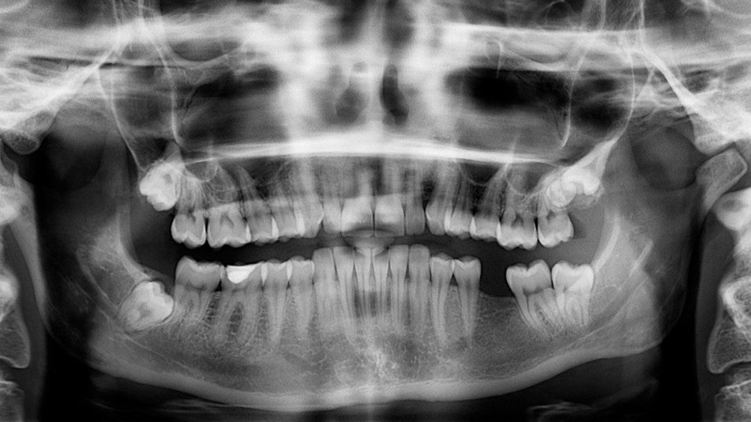 10 Deadly science experiments gone wrong Eskify