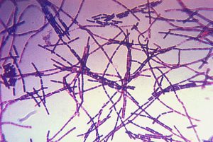 Bacillus_anthracis_Gram North Korean Experiments