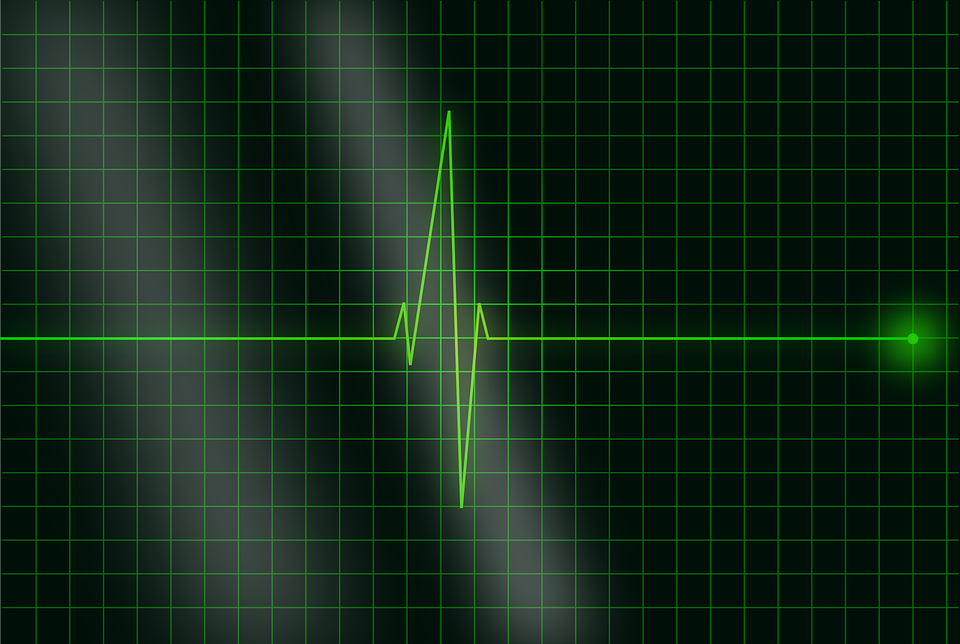 electrocardiogram