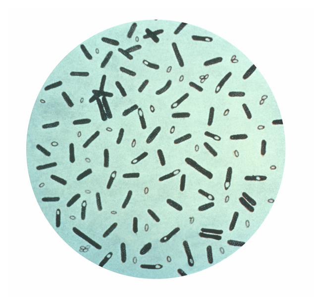 Clostridium_botulinum_01